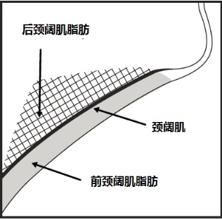 Kybella(去氧胆酸[deoxycholic <wbr>acid])注射液使用说明书2015年第一版